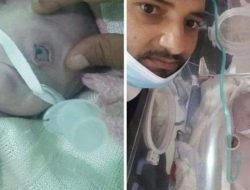 Muncul Banyak Spekulasi Lahirnya Seorang Bayi Bermata Satu di Yaman