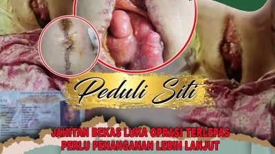 Awak media Melawi Akan Melakukan OPEN DONASI PEDULI SITI