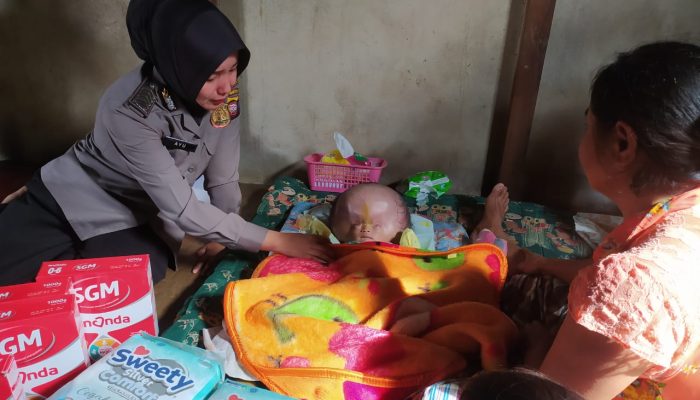 HUT Polwan ke – 75, Polwan Polres Melawi Berikan Bantuan Kepada Bayi Penderita Hidrochepalus