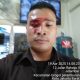 Sekolah Santo Kristoforus Grogol Tidak Aman, Sesama Satpam Baku Hantam